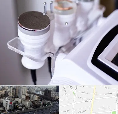 مرکز لاغری با کویتیشن در زرتشت