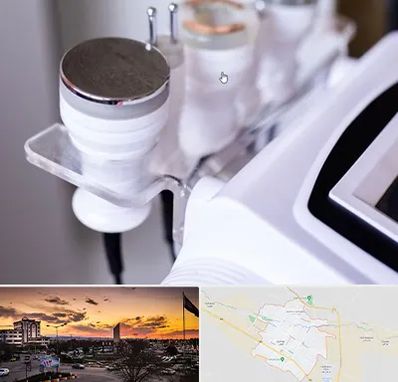 مرکز لاغری با کویتیشن در قوچان