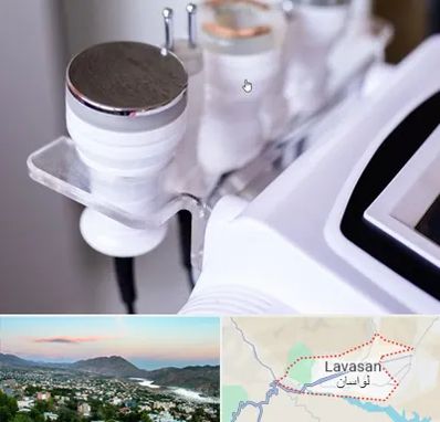 مرکز لاغری با کویتیشن در لواسان