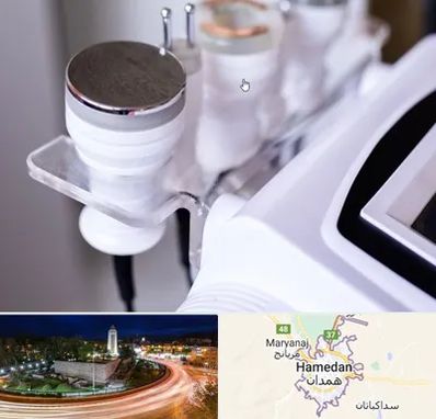 مرکز لاغری با کویتیشن در همدان