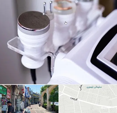 مرکز لاغری با کویتیشن در خیابان قزوین