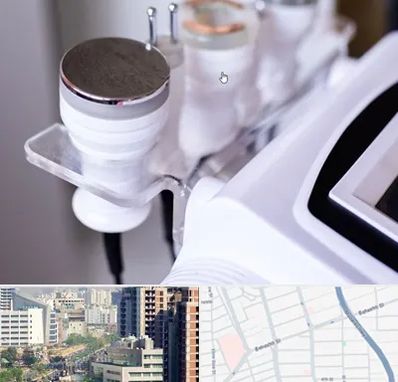 مرکز لاغری با کویتیشن در خیابان بهشتی