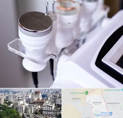 مرکز لاغری با کویتیشن در ولنجک 