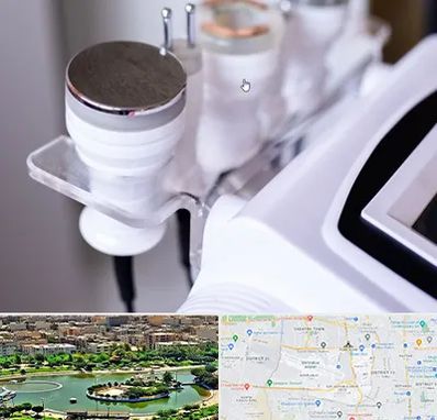 مرکز لاغری با کویتیشن در منطقه 9 تهران 