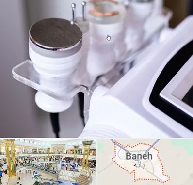 مرکز لاغری با کویتیشن در بانه