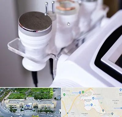 مرکز لاغری با کویتیشن در نسیم شهر