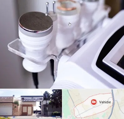 مرکز لاغری با کویتیشن در وحیدیه شهریار