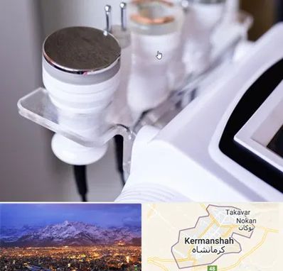 مرکز لاغری با کویتیشن در کرمانشاه