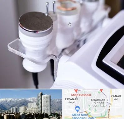 مرکز لاغری با کویتیشن در شهرک غرب 