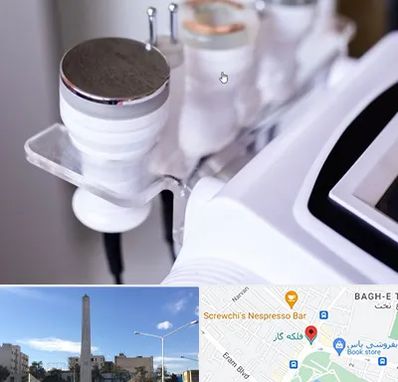 مرکز لاغری با کویتیشن در فلکه گاز شیراز