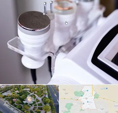 مرکز لاغری با کویتیشن در کاشمر