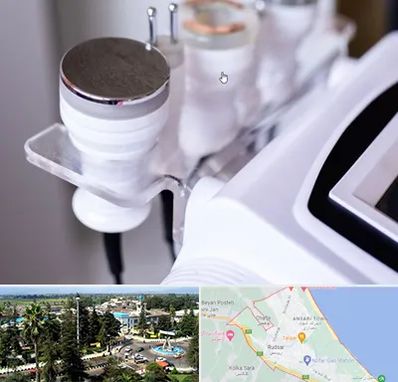 مرکز لاغری با کویتیشن در رودسر