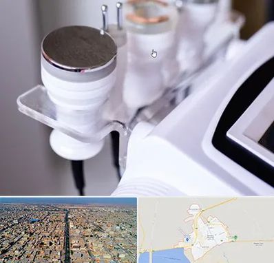 مرکز لاغری با کویتیشن در بندر ماهشهر