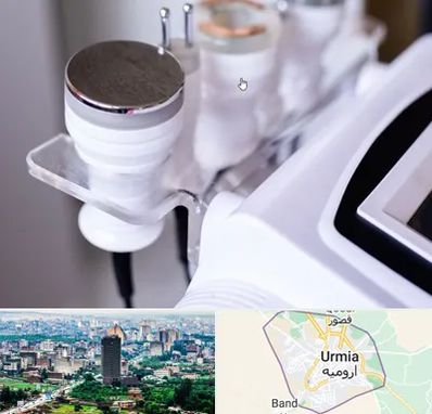 مرکز لاغری با کویتیشن در ارومیه