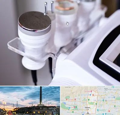 مرکز لاغری با کویتیشن در منطقه 2 تهران 