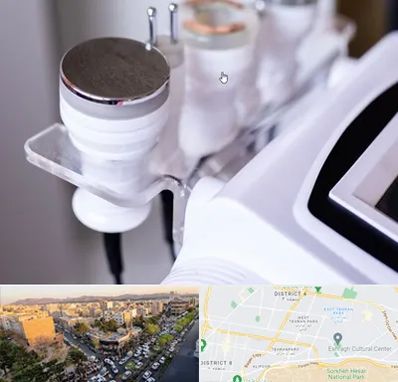 مرکز لاغری با کویتیشن در تهرانپارس 