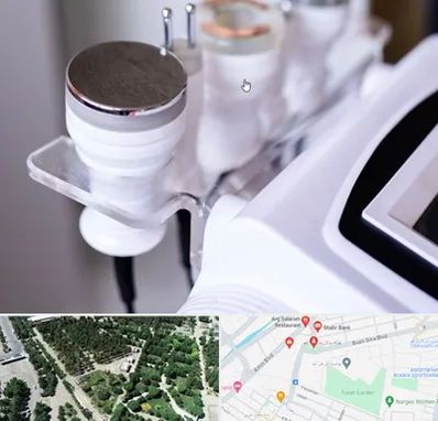 مرکز لاغری با کویتیشن در سالاریه قم