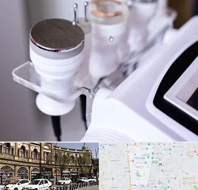 مرکز لاغری با کویتیشن در منطقه 11 تهران 