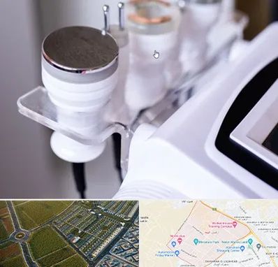 مرکز لاغری با کویتیشن در الهیه مشهد 