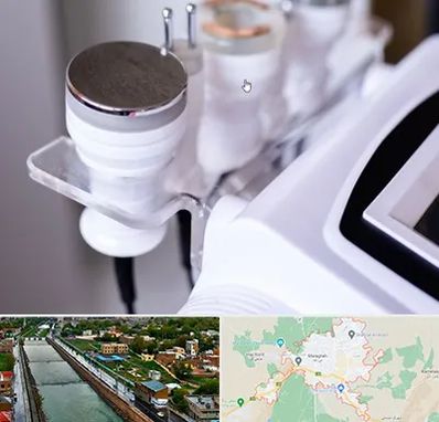 مرکز لاغری با کویتیشن در مراغه