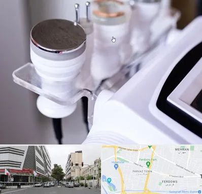 مرکز لاغری با کویتیشن در بلوار فردوس 