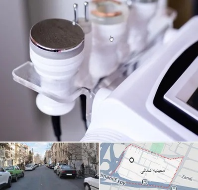 مرکز لاغری با کویتیشن در مجیدیه شمالی