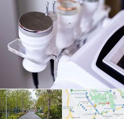 مرکز لاغری با کویتیشن در قدوسی غربی شیراز 