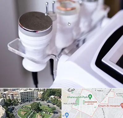 مرکز لاغری با کویتیشن در جهانشهر کرج 