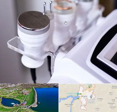 مرکز لاغری با کویتیشن در مهاباد