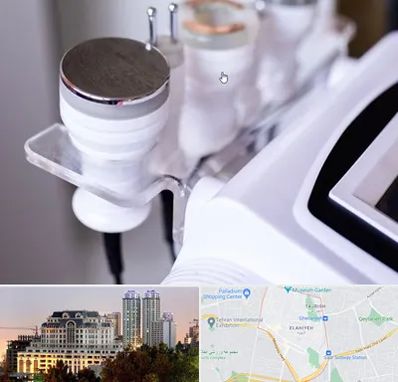 مرکز لاغری با کویتیشن در فرشته 