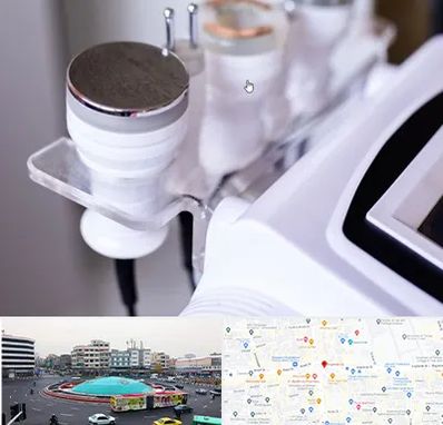 مرکز لاغری با کویتیشن در میدان انقلاب 