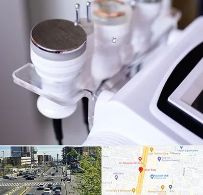 مرکز لاغری با کویتیشن در ستاری 