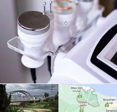 مرکز لاغری با کویتیشن در چالوس