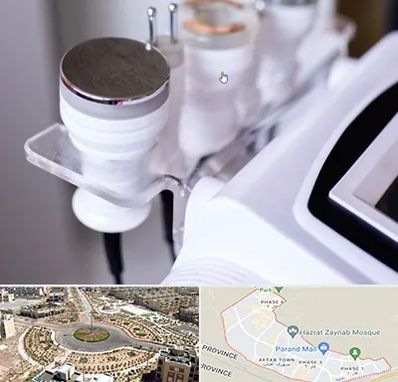 مرکز لاغری با کویتیشن در پرند