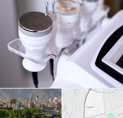 مرکز لاغری با کویتیشن در جمشیدیه