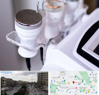 مرکز لاغری با کویتیشن در بلوار فردوسی مشهد 