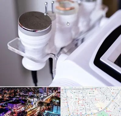 مرکز لاغری با کویتیشن در منظریه رشت 