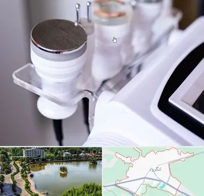 مرکز لاغری با کویتیشن در لنگرود