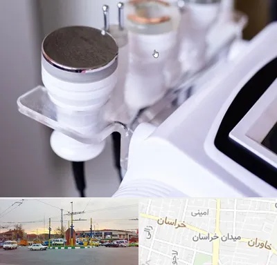 مرکز لاغری با کویتیشن در میدان خراسان