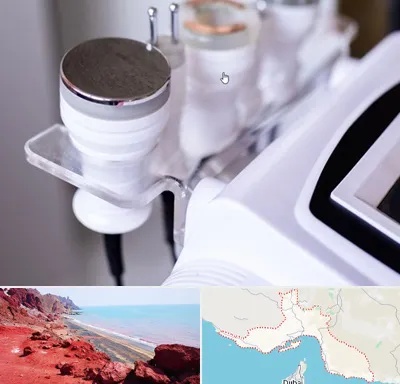 مرکز لاغری با کویتیشن در هرمزگان