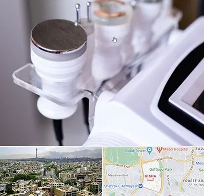 مرکز لاغری با کویتیشن در گیشا 