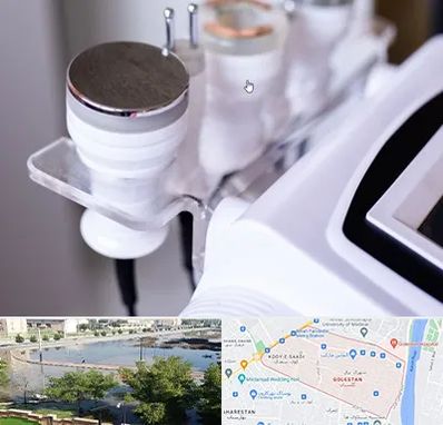 مرکز لاغری با کویتیشن در گلستان اهواز 