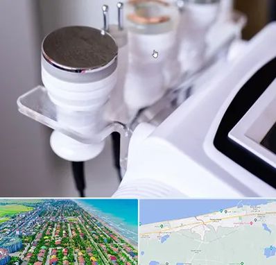 مرکز لاغری با کویتیشن در فریدونکنار