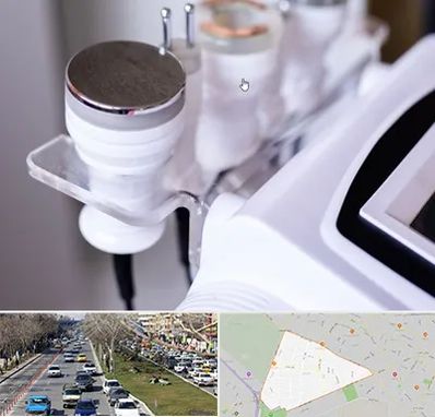 مرکز لاغری با کویتیشن در احمدآباد مشهد 