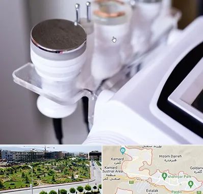 مرکز لاغری با کویتیشن در پردیس