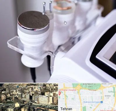 مرکز لاغری با کویتیشن در مرزداران 