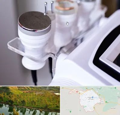 مرکز لاغری با کویتیشن در بهبهان