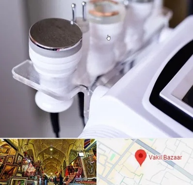 مرکز لاغری با کویتیشن در بازار وکیل شیراز