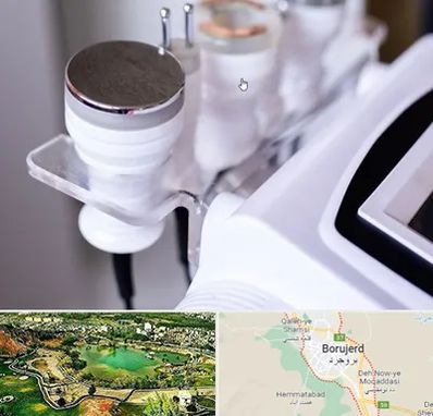 مرکز لاغری با کویتیشن در بروجرد