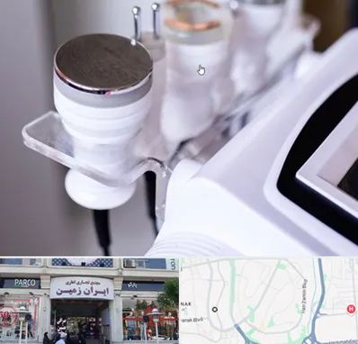 مرکز لاغری با کویتیشن در ایران زمین